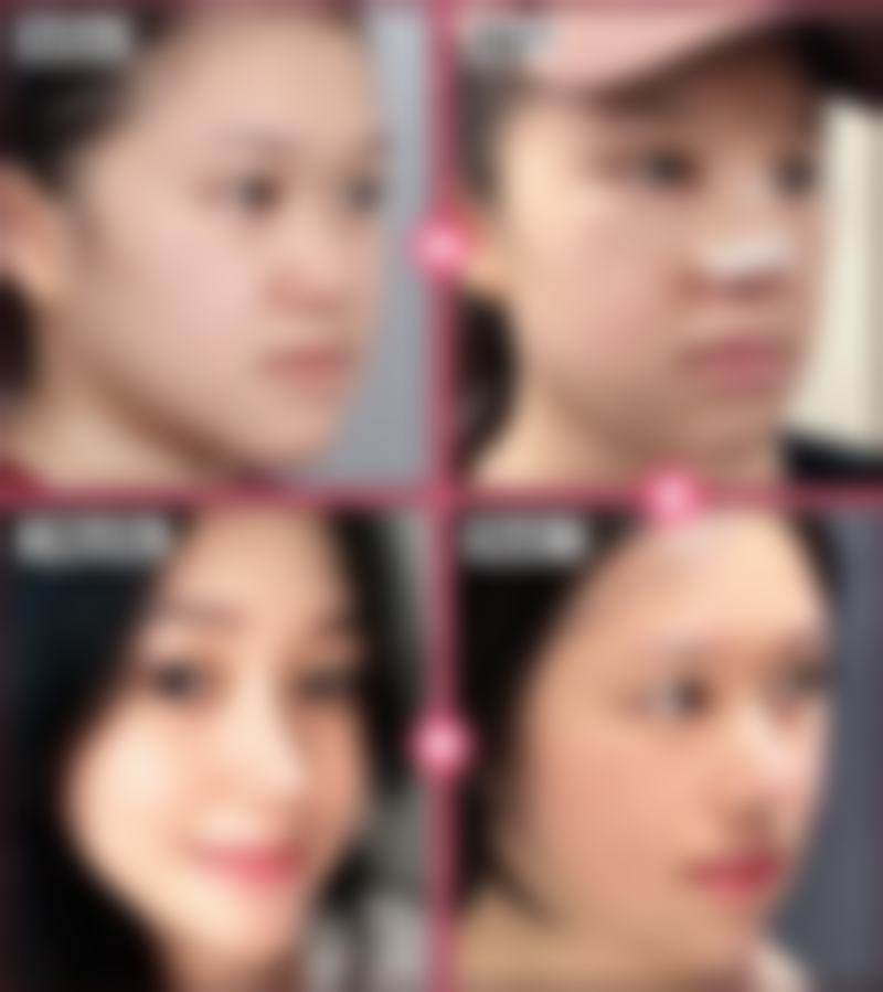 内江达芬奇（原内江瑞美）医疗美容整形门诊部正规吗？看资质