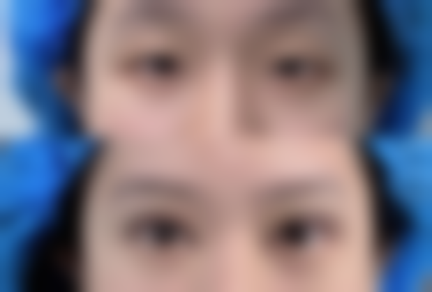 十堰安琪儿整形医院实例参考