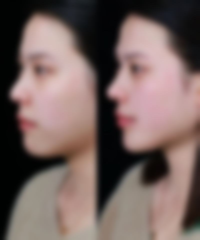 北京焕誉医疗美容医院正规吗？看资质