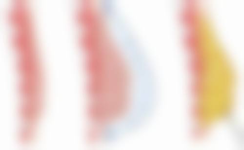 盐城美芭美学医疗门诊部价格表(仅供参考)