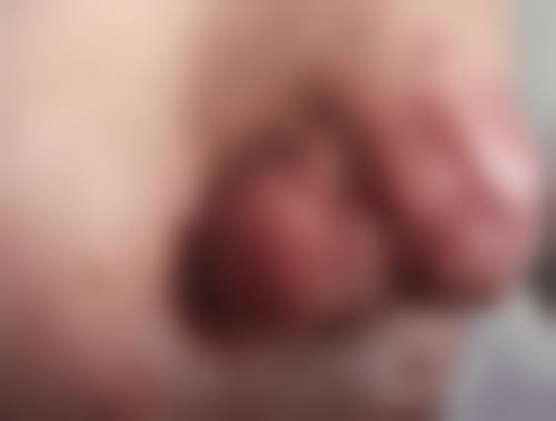 phd皮肤科怎么预约？