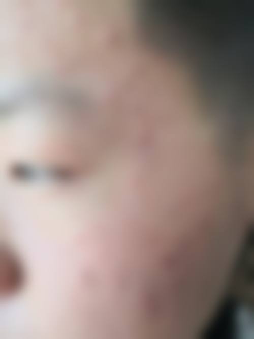 phd皮肤科医生团队