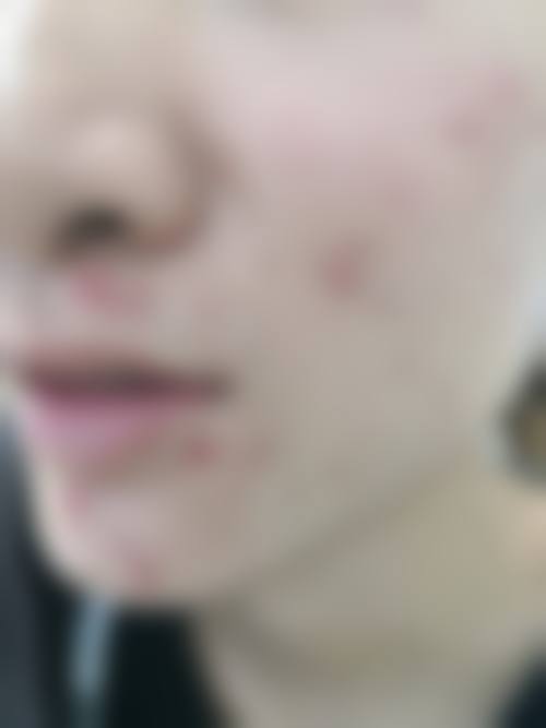 phd皮肤科核心项目