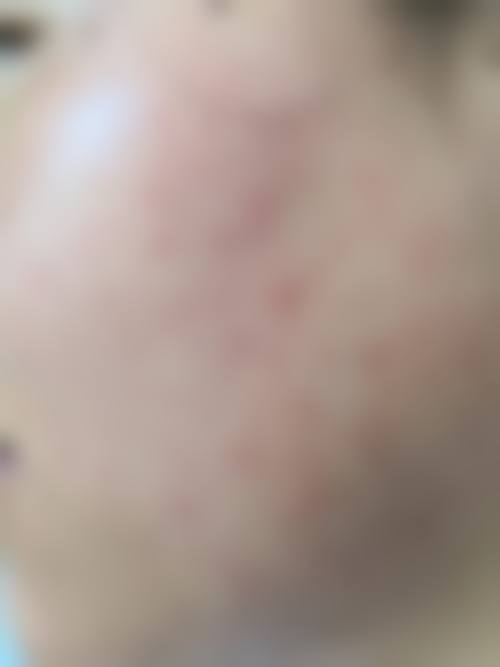 phd皮肤科实例参考