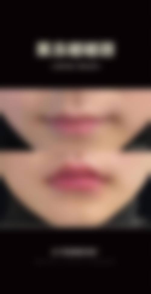 西安高新凯娜思整形医院怎么预约？