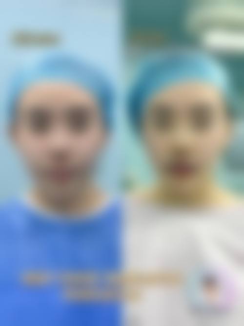 西安高新凯娜思整形医院实例参考