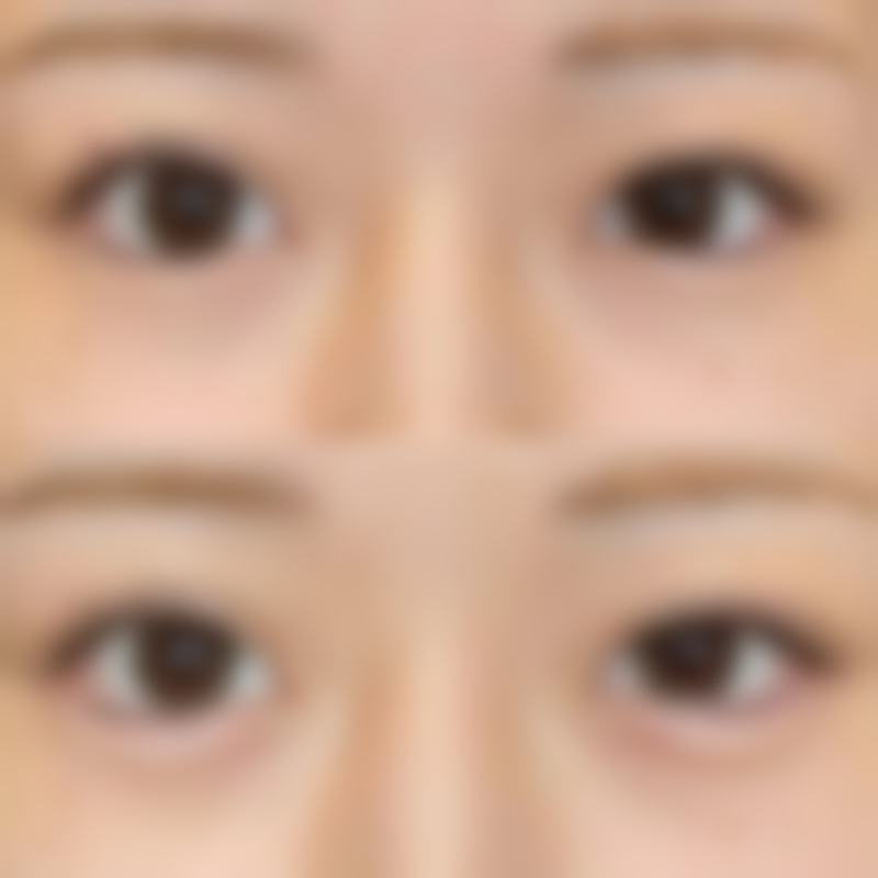 南京华瑞欣医疗美容门诊部价格表(仅供参考)