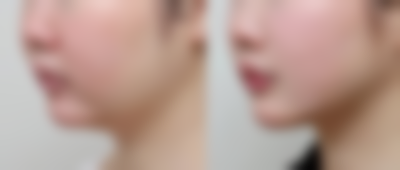 牟敏预约方式及价格表