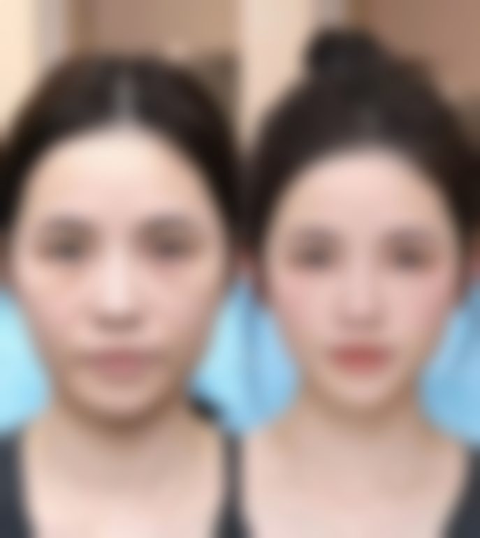 TCB下关价格表（仅供参考）