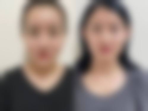 诸暨晨熹颜星医疗美容诊所怎么预约？