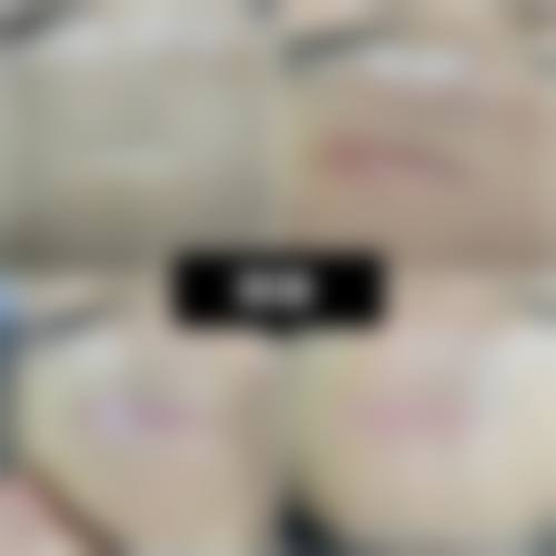 广州健肤皮肤专科门诊部怎么预约？