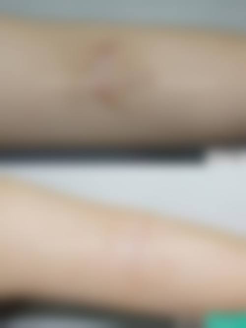 广州健肤皮肤专科门诊部核心项目