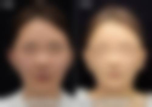 北京华夏医美医疗整形美容医院怎么预约？