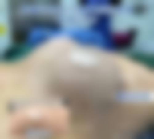 东莞整形美容医院实例参考