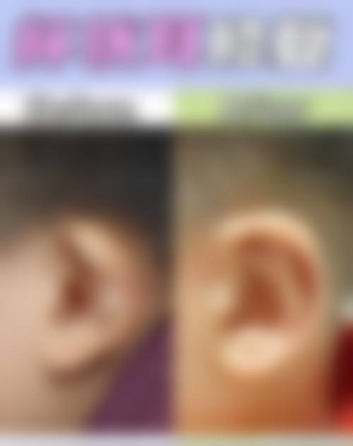 长沙青和医疗美容实例参考