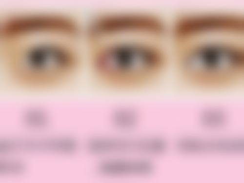 北京华夏医美医疗整形美容医院实例参考