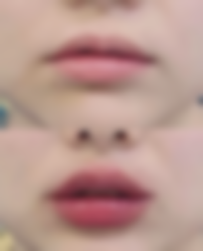 诸暨晨熹颜星医疗美容诊所正规吗？看资质