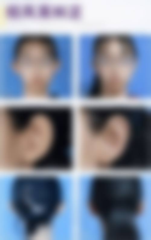 成都熙月医疗美容诊所怎么预约？