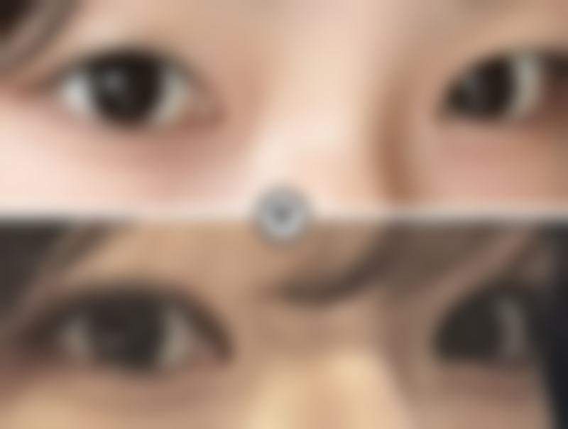 南京千美医疗美容门诊部怎么预约?