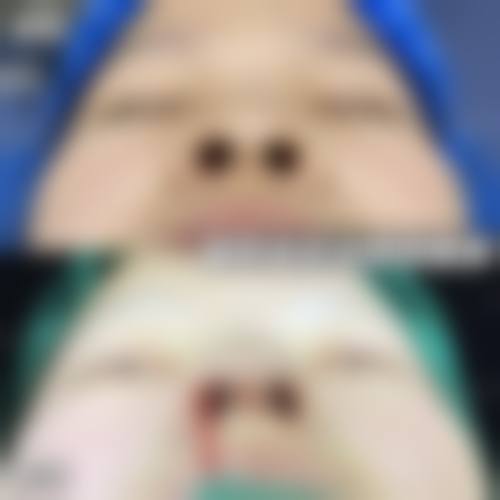 海口海沪宁整形医院擅长项目