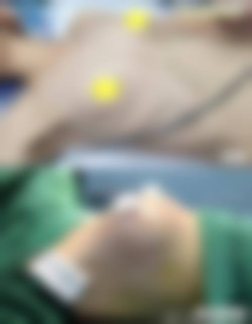 海口海沪宁整形医院价格表(仅供参考)