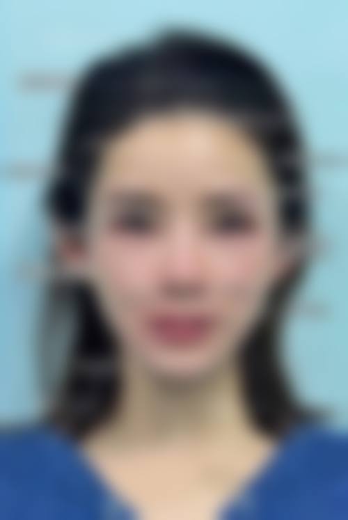 攀枝花中 心医院美容整形医院实例参考