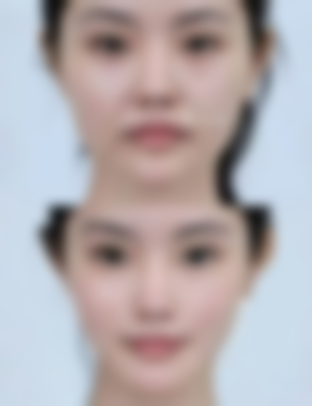 福州悦己整形医疗美容中 心擅长项目