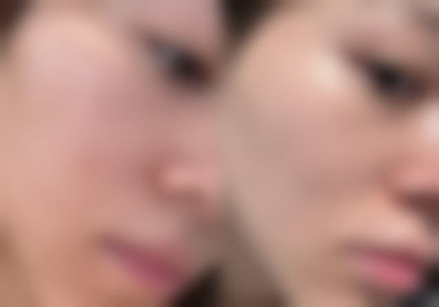 福州悦己整形医疗美容中 心实例参考