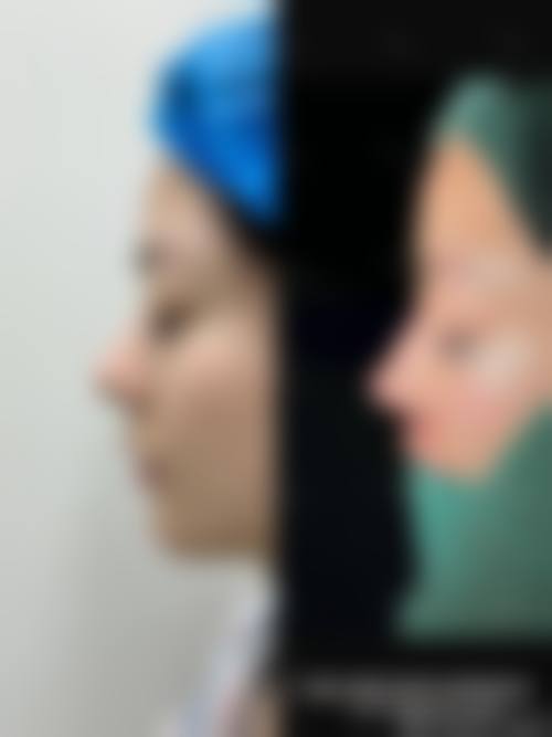 合肥蝶之星医疗美容门诊部地址及到院路线