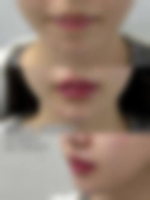 安庆艾诺体检中 心整形科怎么预约？