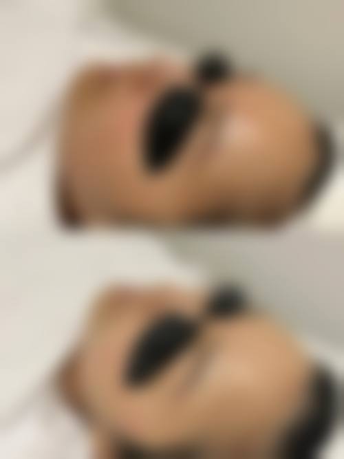 伊宁王茜医疗美容整形诊所实例参考