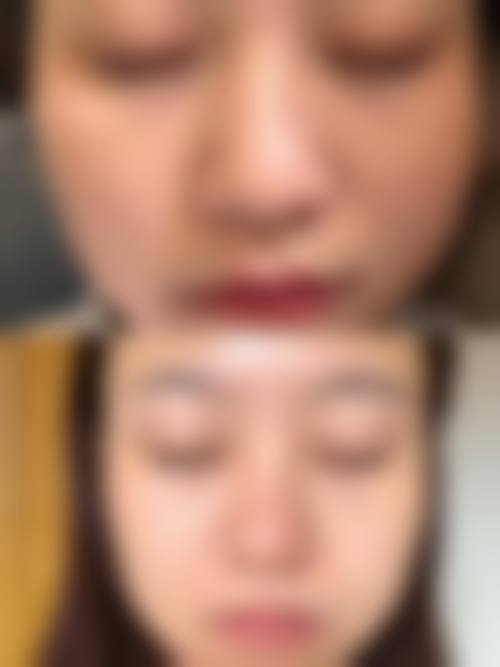 Lucia Clinic 福冈天神价格表（仅供参考）