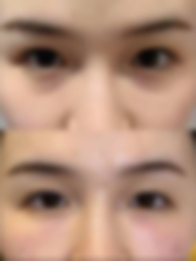 成都亚鑫时尚医美实例参考