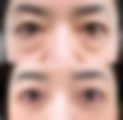 北京亦庄同仁医院整形美容中 心价格表(仅供参考)