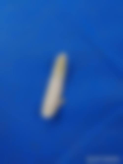 韩国丽倍摞女性私密整形医院实例参考