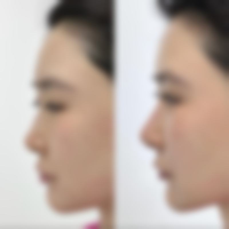 蚌埠经济开发区东方美莱坞医疗美容门诊部怎么预约？