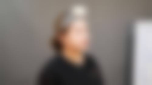 昆明华希医院医疗整形美容科怎么预约?