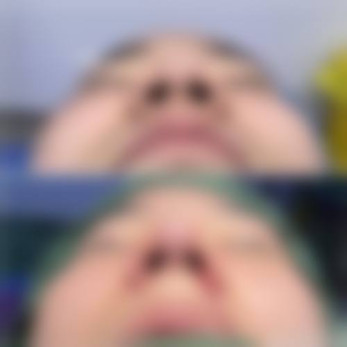 首尔美线整形医院怎么预约？