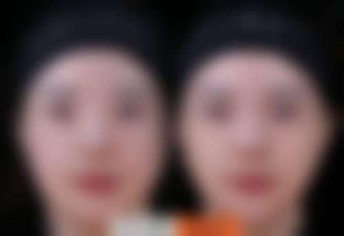 信阳中 心医院烧伤整形外科怎么预约?