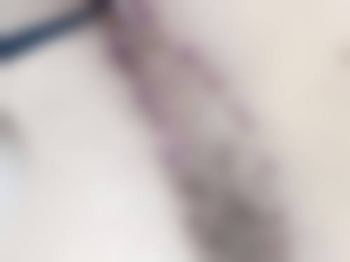 武汉优容不剃发植发医院实例参考