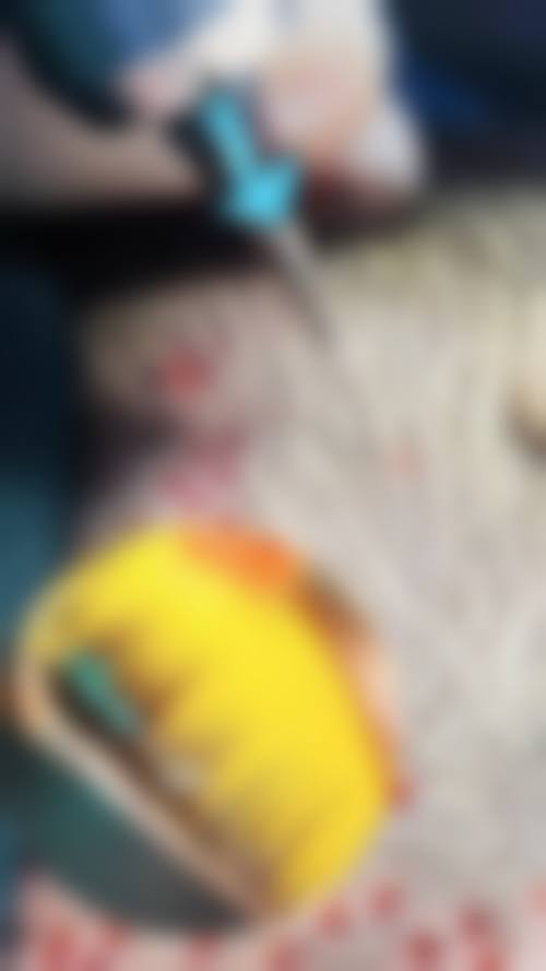 武汉优容不剃发植发医院擅长项目