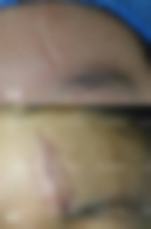 太原鑫晨聚美美容门诊部实例参考