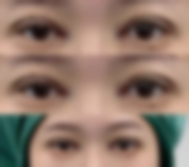 长沙嘉丽整形美容门诊部价格表（仅供参考）