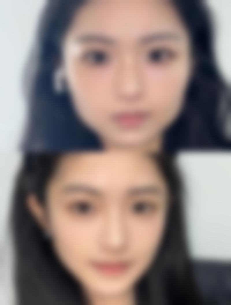 太原鑫晨聚美美容门诊部价格表（仅供参考）