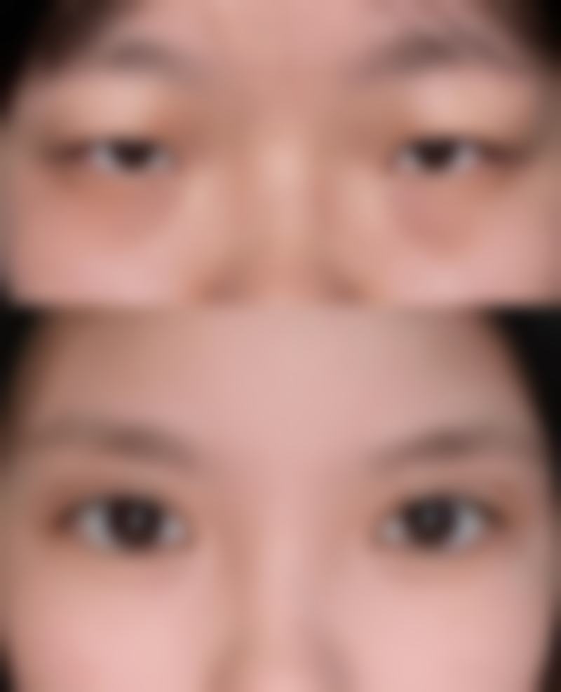 深圳镜面芝华整形医院擅长项目