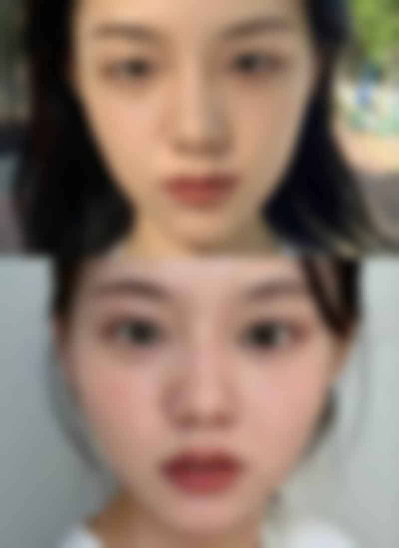 重庆德艺阿蓝整形美容门诊部实例参考