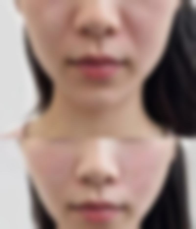 深圳同步齿科价格表(仅供参考)