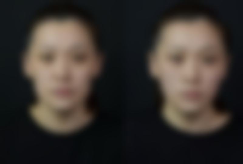 郑州阳光整形美容擅长项目