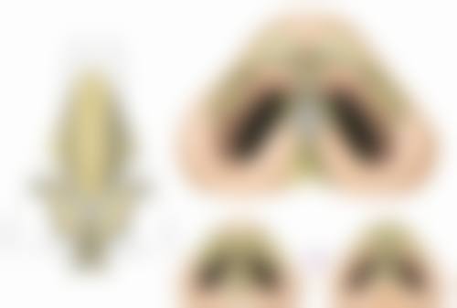 南京宁美整形医疗美容门诊部怎么预约？