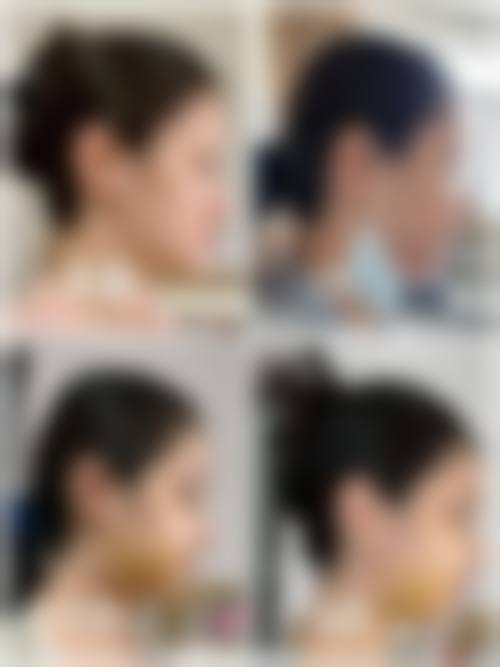 南京宁美整形医疗美容门诊部擅长项目